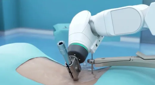 Risiko Bedah Berbasis AI: Laporan Malfungsi dan Cedera Pasien Meningkat Tajam