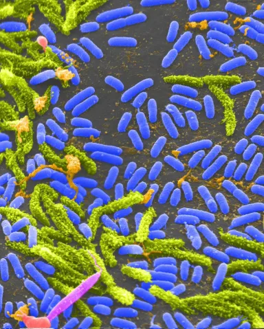 Persistensi Antibiotik: Mengapa Bakteri Bisa Bertahan Hidup Tanpa Menjadi Resisten?