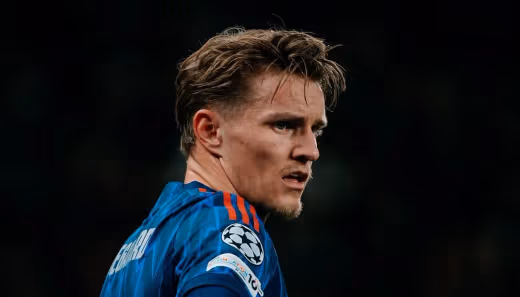 Martin Odegaard Konfirmasi Cedera Baru, Kabar Buruk bagi Arsenal Jelang Laga Kontra Man City