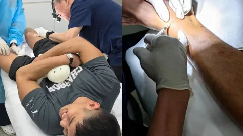 Gigitan Lalat Pasir Bikin Aktor Singapura Elvin Ng Jalani Suntik Steroid Berulang