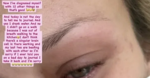 Bella Hadid Berurai Air Mata Akibat Kambuhnya Penyakit Lyme: Mandi Tanpa Pingsan Jadi Prestasi