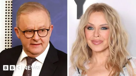 Albanese Minta Maaf Usai Komentar Tak Pantas soal Kylie Minogue: Sebuah Pengingat soal Etika Pejabat Publik