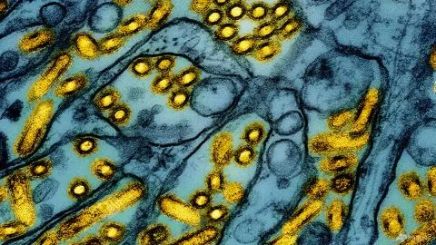H5N1 Menginfeksi Elang Asli Selandia Baru, Kekhawatiran Meluas ke Unggas