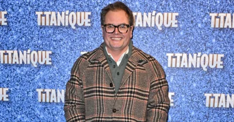 Anjing Tuli Alan Carr Serang Sporran Pemain Bagpipe, Komedian Malah Belain Peliharaan