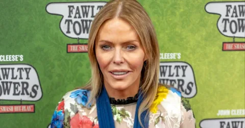 Momen Tak Terlupakan Patsy Kensit: David Bowie Menyisir Rambutnya tanpa Sepatah Kata