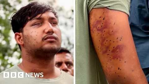 Peluru Burung di Tengah Aksi Massa: Luka Aktivis India Picu Pertanyaan soal Pengendalian Massa