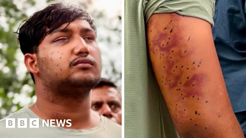 Peluru Burung di Tengah Aksi Massa: Luka Aktivis India Picu Pertanyaan soal Pengendalian Massa