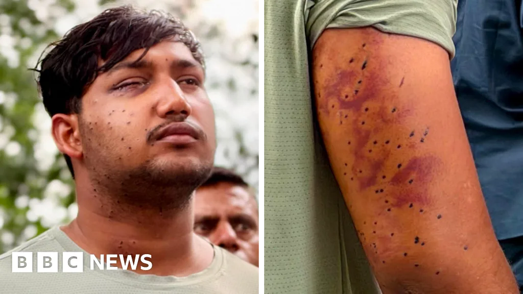 Peluru Burung di Tengah Aksi Massa: Luka Aktivis India Picu Pertanyaan soal Pengendalian Massa