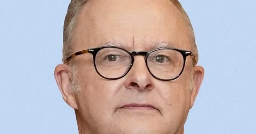 Komentar 'Melon' Albanese soal PM Jepang Memicu Gelombang Kritik: Diplomasi atau Lelucon Tak Senonoh?