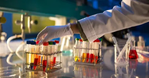 Terapi Tiga Kombinasi pada Primata Berpotensi Hilangkan HIV pada Bayi Baru Lahir
