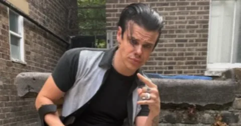 Yungblud Tetap Tampil di Pukkelpop dan CA Vilar de Mouros Meski Patah Kaki: 'Masih Giggin'
