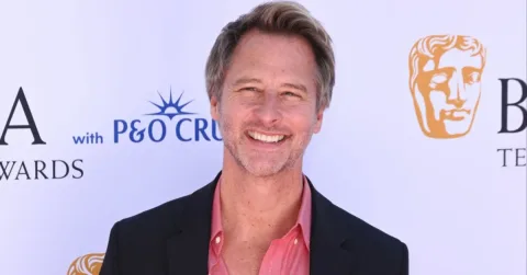 Chesney Hawkes Ungkap Kerenggangan dengan Rekan Celebrity Big Brother, Mickey Rourke Putus Kontak