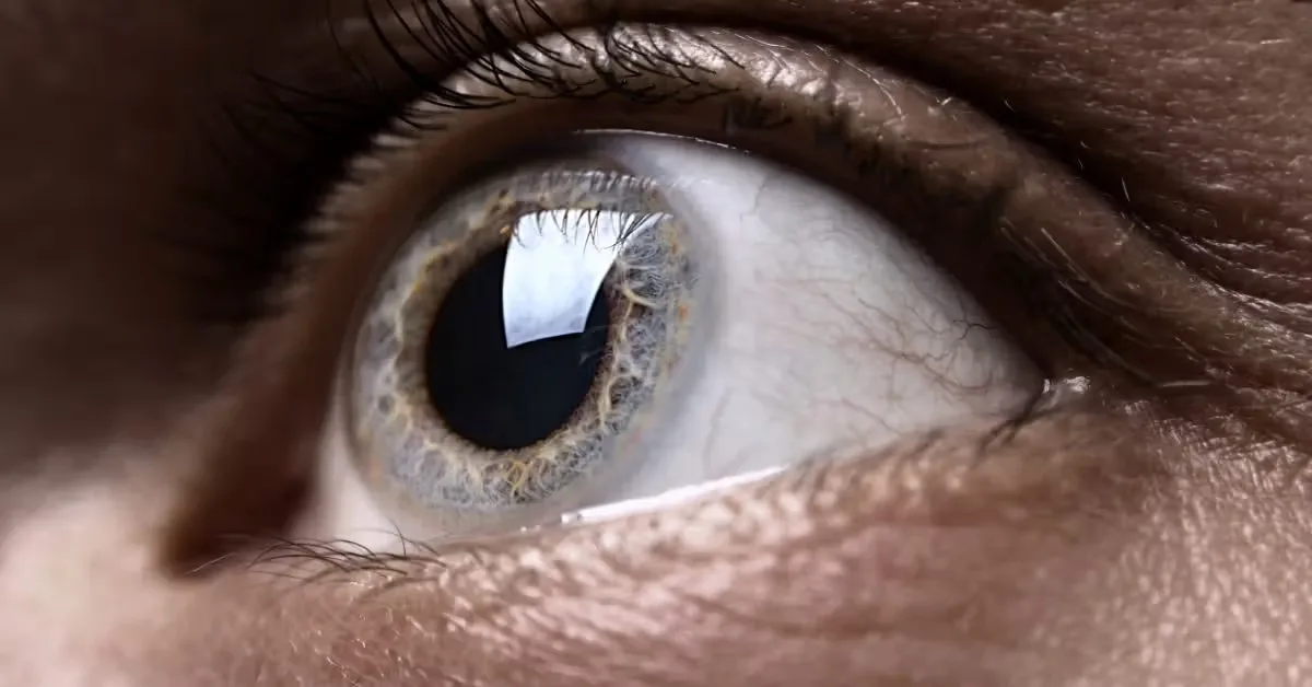 Retina May Signal AFib Up to 4 Years Before Diagnosis