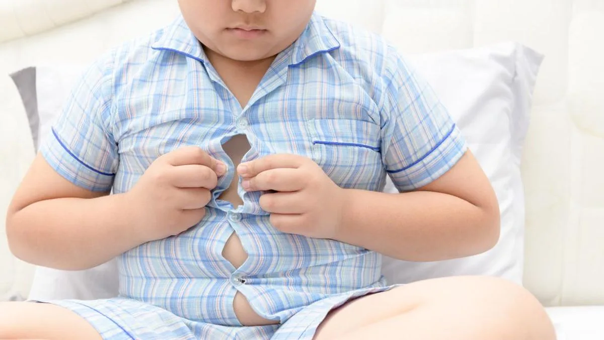 Obesitas Anak Bukan Sekadar Soal Berat Badan: Ancaman Diabetes hingga Apnea Tidur Mengintai Sejak Dini