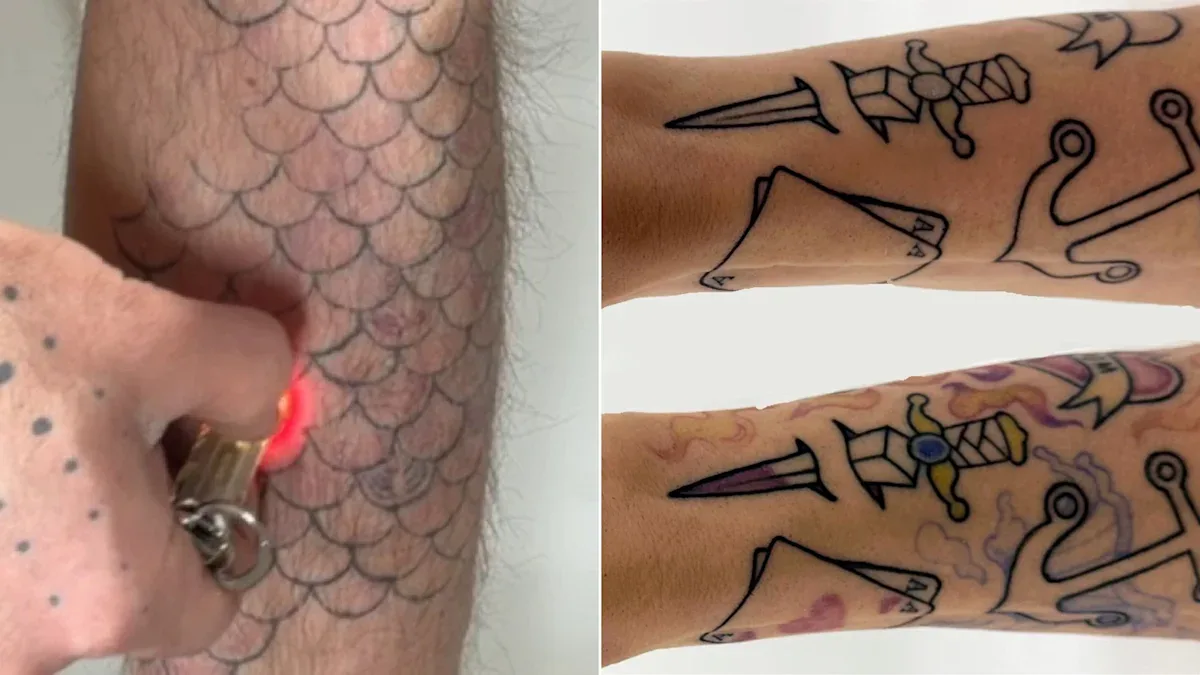 PhotoTat: Tinta Tato yang Bisa Dimatikan dengan Sinar UV, Solusi untuk Profesional