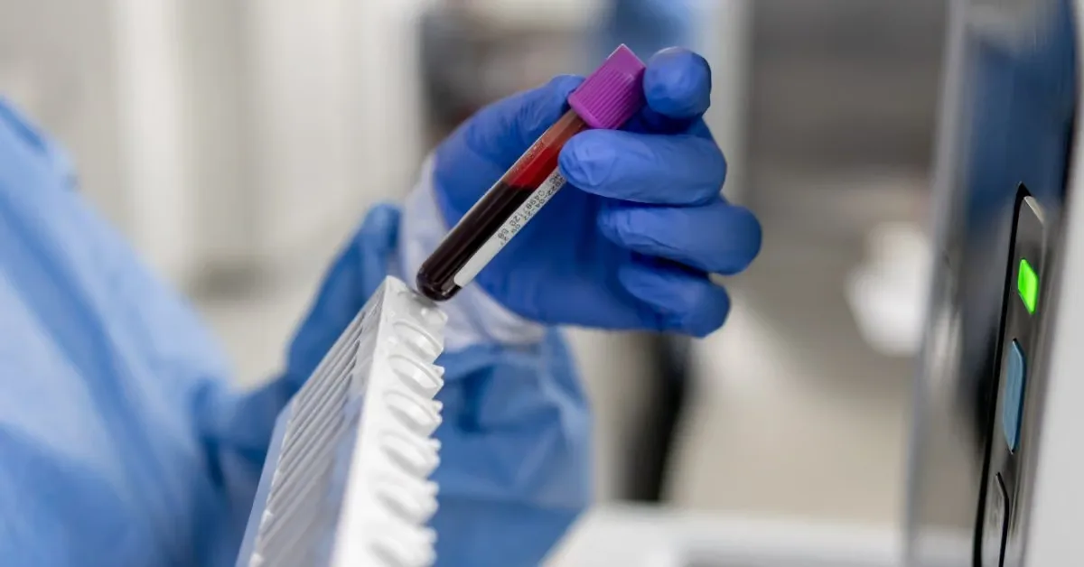 Oxford Study: Prostate Cancer Risk Can Be Detected in Blood 15 Years Before Diagnosis