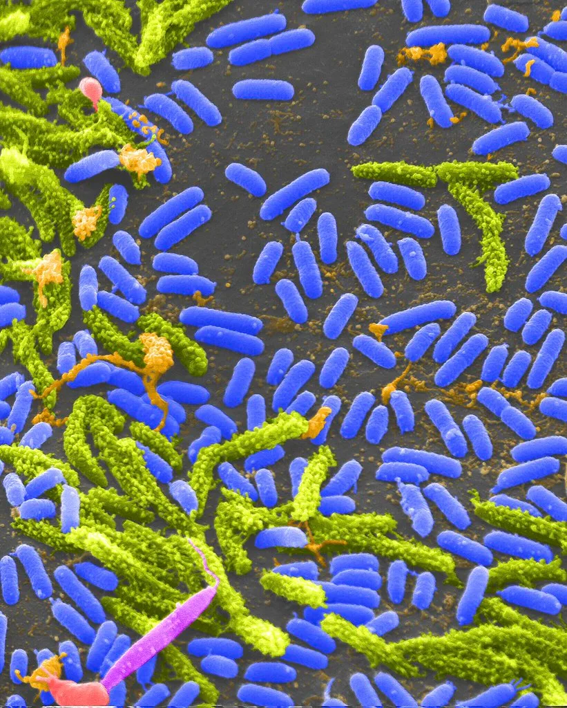 Persistensi Antibiotik: Mengapa Bakteri Bisa Bertahan Hidup Tanpa Menjadi Resisten?