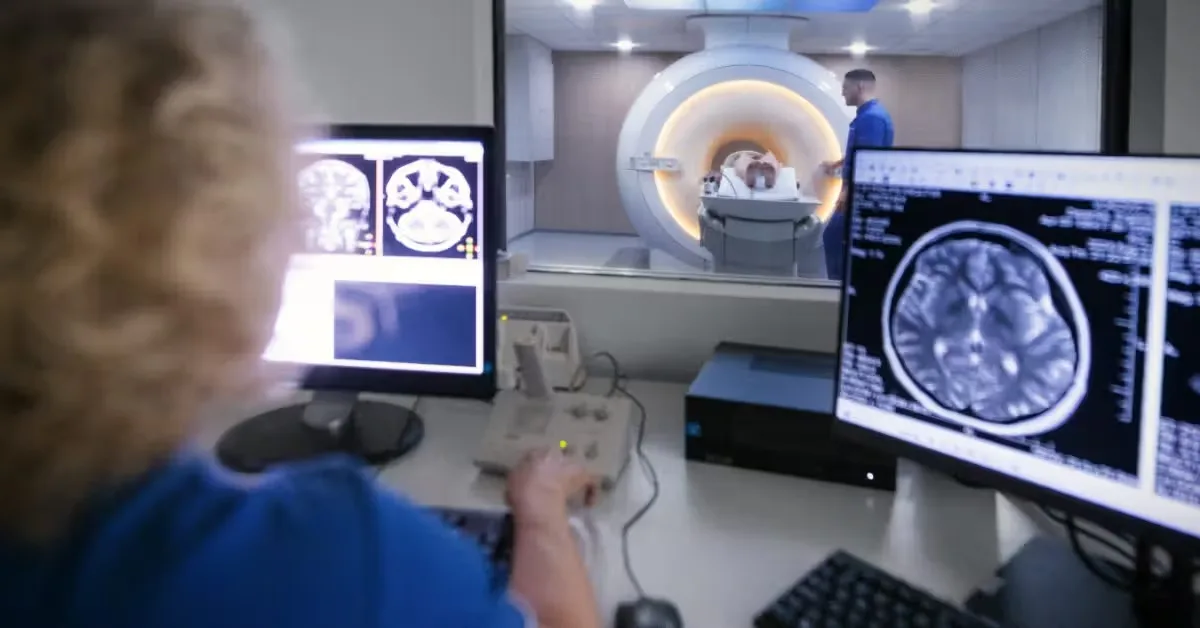 Studi AS: AI Temukan 55 Aneurisma Otak yang Terlewat dari Mata Radiolog