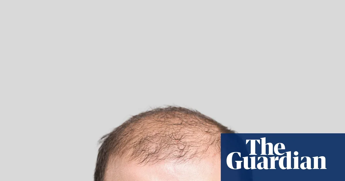 Mengapa Rambut Kemaluan Disebut 'Detektor Perselingkuhan'? Sains Mengungkap Evolusi Rambut Tubuh Manusia